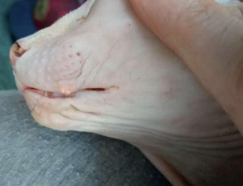 Did You Know Hairless Cats Get Acne Too?